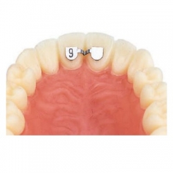 Upper Retainer Central To Central 6mm Leone